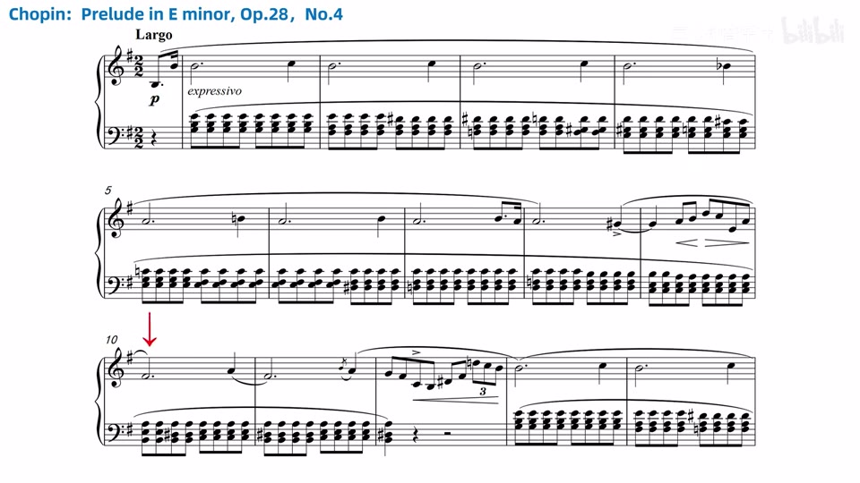 肖邦 E 小调前奏曲 Op.28 No.4 的三行谱例，上方长音跨越拍点，下方和弦型持续变化